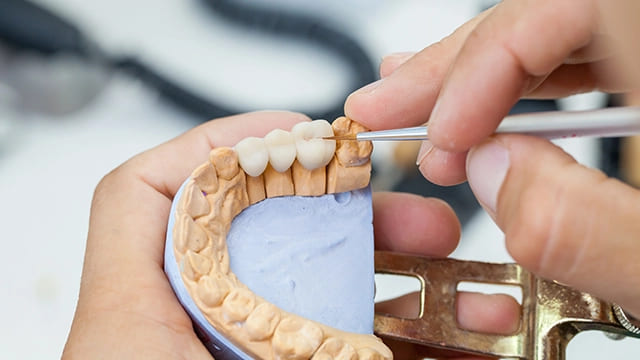 セラミックに特化した歯科技工士「セラミスト」が理想を実現
