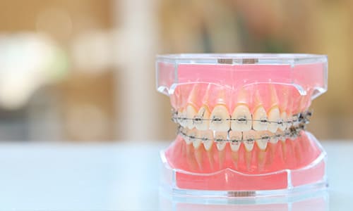 美しい歯並びと正しい噛み合わせを叶える矯正歯科治療
