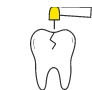 虫歯治療・根管治療口腔外科（親知らずの抜歯）